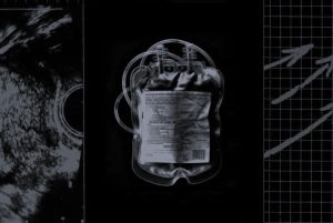Miscarriage Is Increasingly Dangerous for Women in Texas 20 070825-01-Abortion-Health