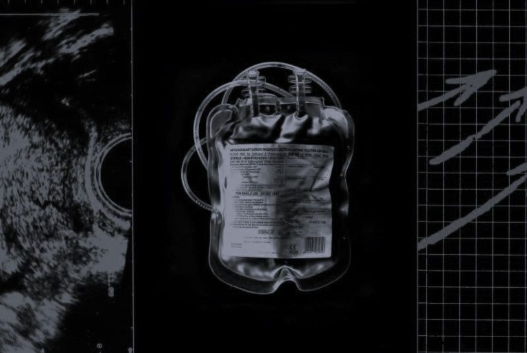 Miscarriage Is Increasingly Dangerous for Women in Texas 13 070825-01-Abortion-Health