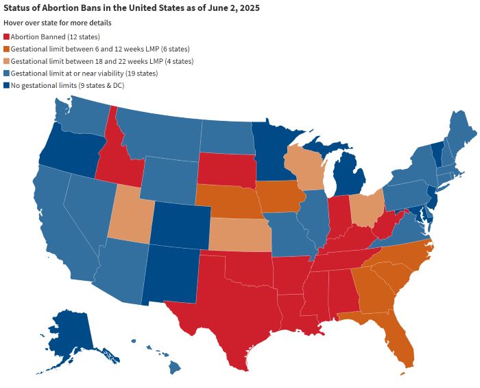 U.S. abortion bana as of June 2, 2025