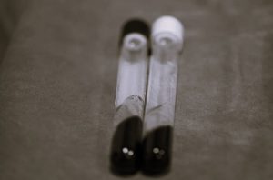 Healing from Within: The Science (and Surprising Simplicity) of PRP 18 HealingScience-SarahMejia01