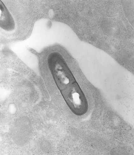 The Pastoral Illusion: Why Raw Milk’s Rustic Image Masks Real Dangers 12 Micrograph of Listeria monocytogenes bacterium in tissue
