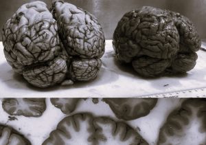 Blue Promises, Murky Truths: The Methylene Blue Hype and Its Hidden Risks 12 081125-13-Health-Nutrition