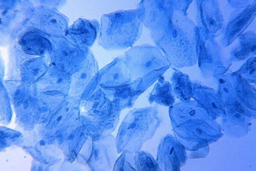 Blue Promises, Murky Truths: The Methylene Blue Hype and Its Hidden Risks 12 Human cheek cells stained with methylene blue