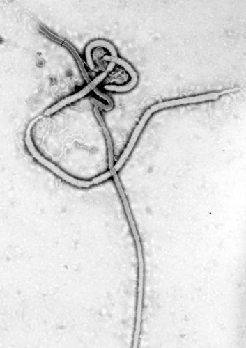 Shadows in the Blood: A History of Ebola Virus and Its Outbreaks 8 Shadows in the Blood: A History of Ebola Virus and Its Outbreaks
