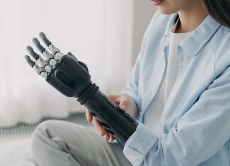 How Shoulder Disarticulation Prostheses Restore Mobility and Independence 6 COMDMOCT00041-HannahGilbert02