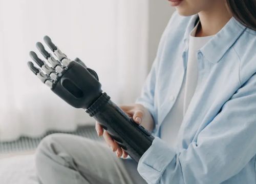 How Shoulder Disarticulation Prostheses Restore Mobility and Independence 2 How Shoulder Disarticulation Prostheses Restore Mobility and Independence