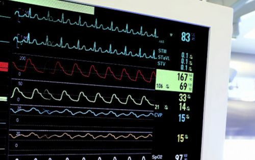 How To Choose The Right Cardiac Diagnostic Test Center For You