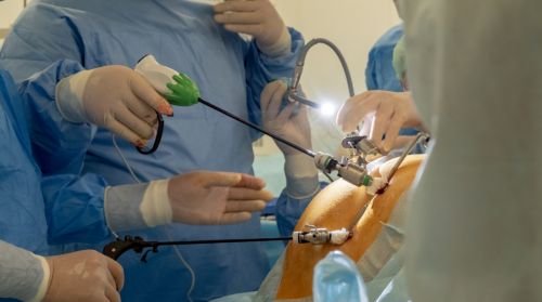 How Minimally Invasive Hernia Surgery Supports Faster Recovery 3 How Minimally Invasive Hernia Surgery Supports Faster Recovery