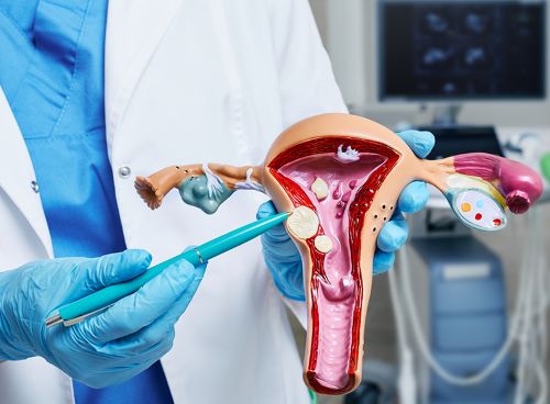Causes and Risk Factors of Uterine Fibroids