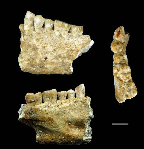 Ancient Dental Technology: Innovation, Pain, and the Origins of Oral Care