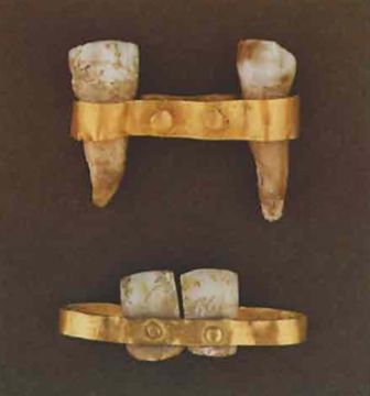 Ancient Dental Technology: Innovation, Pain, and the Origins of Oral Care