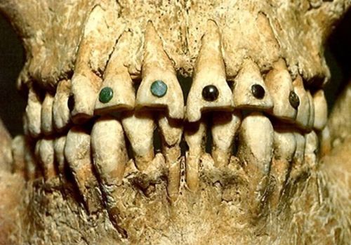 Ancient Dental Technology: Innovation, Pain, and the Origins of Oral Care
