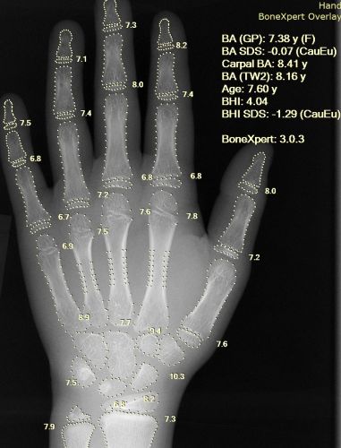 Mechanical Arms to Intelligent Systems: The History of Robotics in Medical Care