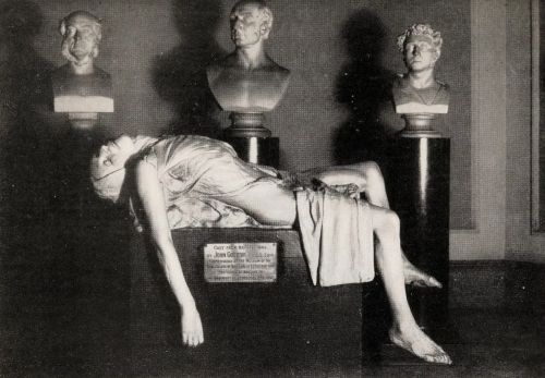 Stealing the Dead: Resurrection Men and Body Snatching in 19th-Century Britain 5 Positioned after the attitude of Michelangeloโs Pieta, the cast of a partially dissected body by John Goodsir, a pupil of the anatomist Robert Knox, ca. 1845