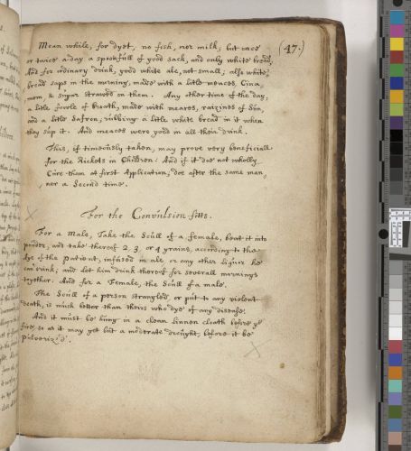 A medieval medical recipe for convulsions recommending the powder of a dead man's skull.