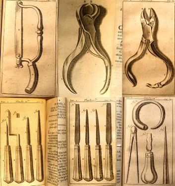 Late 17th-century surgical instruments made by Pierre Fauchard during his research in oral surgery