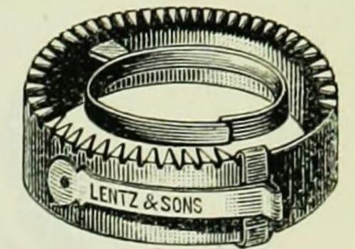 Shockingly Incurable: Victorian Electrotherapy and Useless Medical Devices 10 Spermatorrhea ring, from a 1915 surgical catalogue