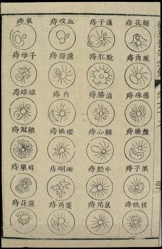 The Mediocre Doctor: Quacks, Fraud, and Medical Trust in Medieval China 11 Diagram detailing 24 types ofย haemorrhoids from the Yuzuan yizong jinjian