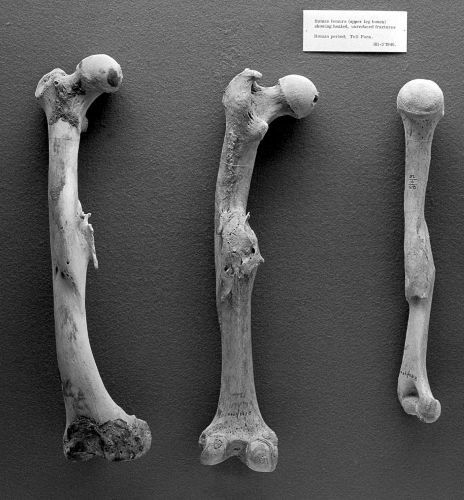 Human femurs and humerus from Roman Period