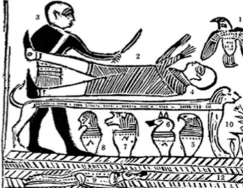 Depiction of amputation in ancient Egypt from the Edwin Smith Papyrus