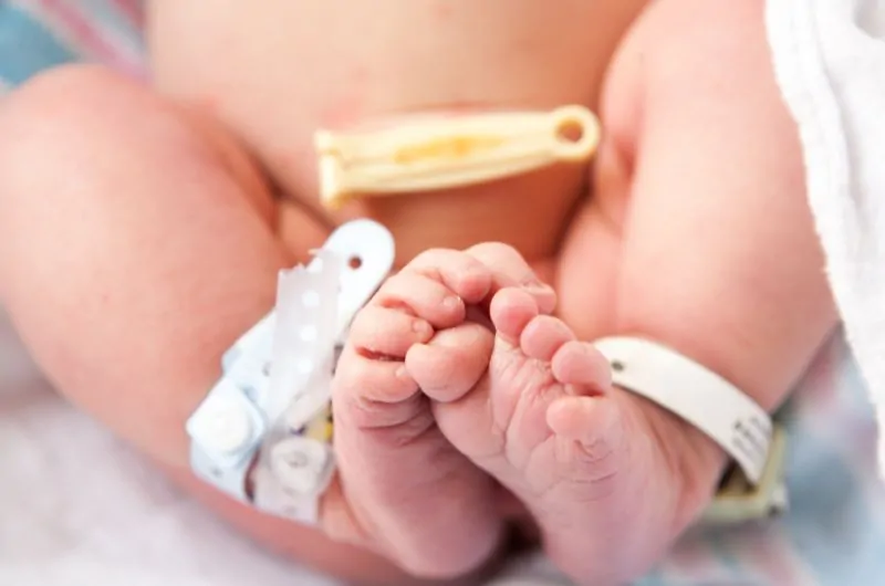 What Are the Less Obvious Signs of Nuchal Cord Complications? 2 What Are the Less Obvious Signs of Nuchal Cord Complications?